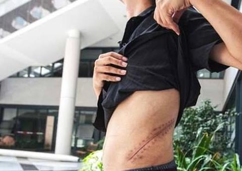 Adolescente decide vender rim no mercado negro para comprar Iphone e se dá mal