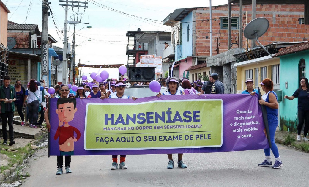 Caminhada em Manaus alerta para a importância do combate à hanseníase