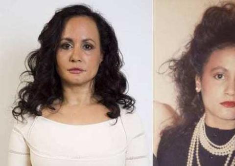 Mulher fica sem sorrir para não ter rugas