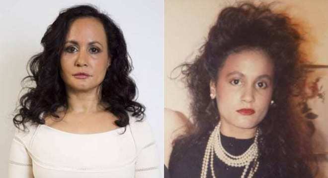 Mulher fica sem sorrir para não ter rugas