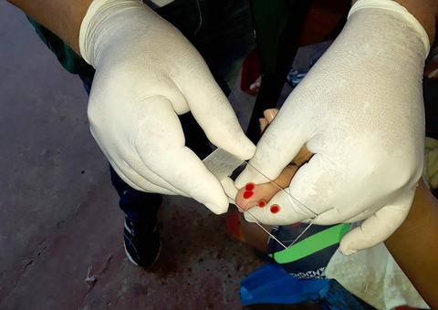 Casos de 'tipo grave' de malária não são registrados em Manaus