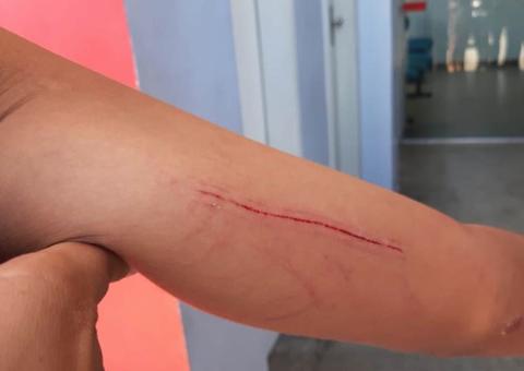 Adolescente afirma que foi estuprada após ser abordada por grupo de 12 homens em Manaus 