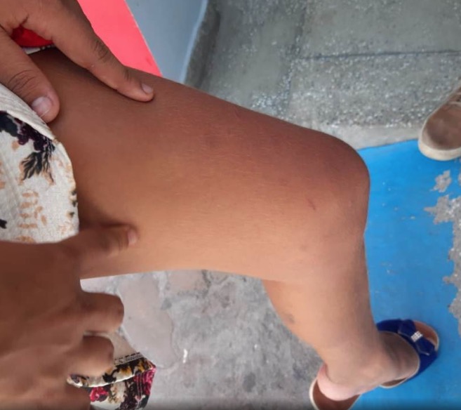 Adolescente afirma que foi estuprada após ser abordada por grupo de 12 homens em Manaus 