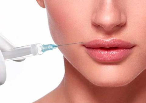 Mitos e verdades sobre o preenchimento labial