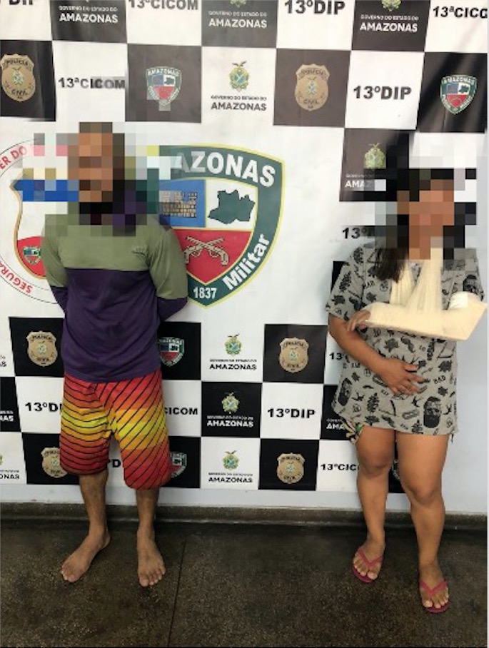 Mulher tem braço e nariz quebrados após ser agredida pelo marido em Manaus 