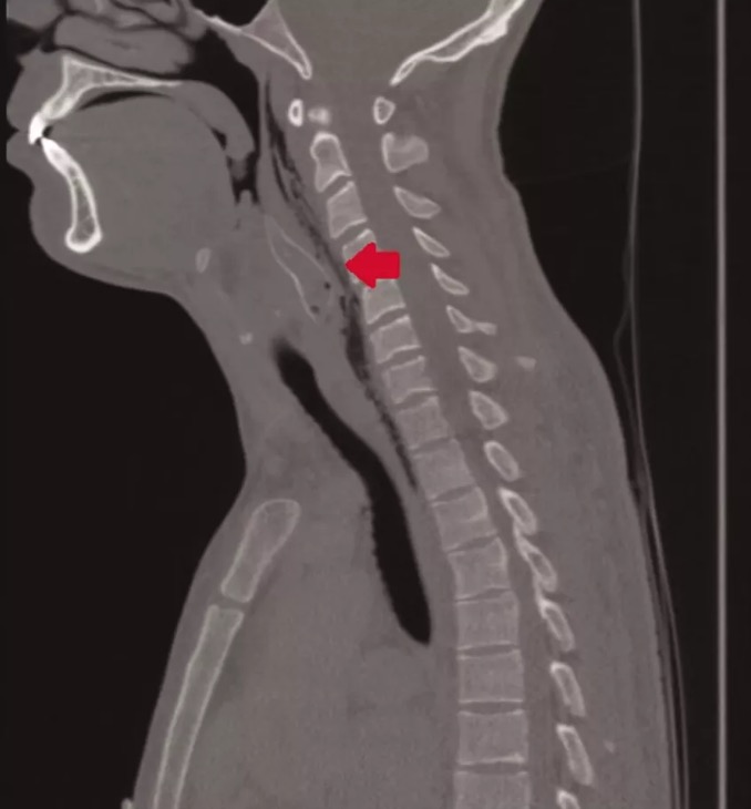 Homem bêbado engole peixe raro vivo e se dá mal