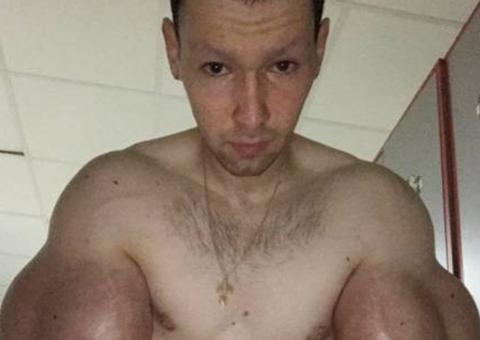 Jovem que injetou óleo no corpo para ter músculos recebe alerta grave de médicos