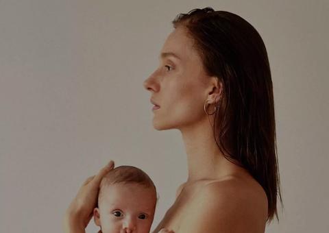    Irmã de Ana Hickmann conta que filho nasceu com lábio leporino e mostra fotos