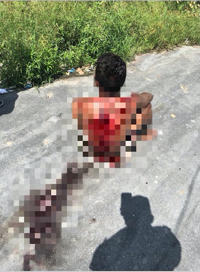 Jovem é espancado e esfaqueado em ´boca de fumo´ em Manaus 