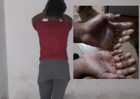 Mãe acusada de queimar filho com ferro vai responder por crime em liberdade