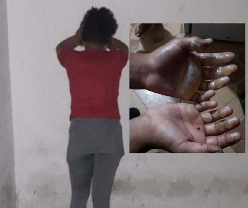 Mãe acusada de queimar filho com ferro vai responder por crime em liberdade