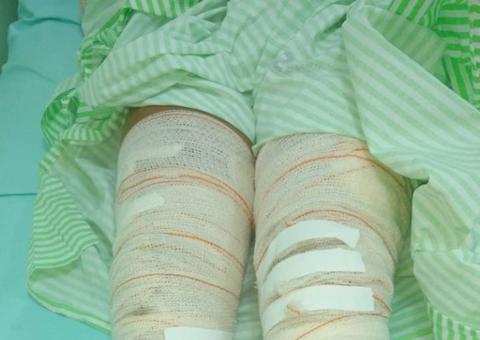 Marido ateia fogo na esposa, exige confissão de traição e é preso