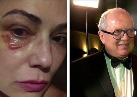 Lírio Parisotto é condenado por agredir Luiza Brunet