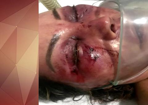 Mulher é espancada ao marcar encontro com jovem que conheceu na internet 