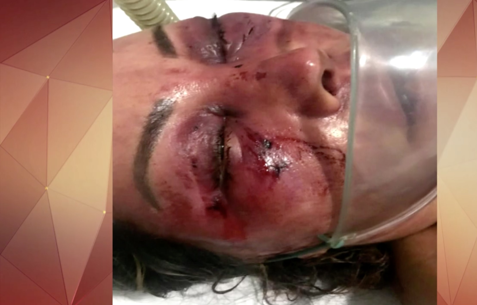 Mulher é espancada ao marcar encontro com jovem que conheceu na internet 