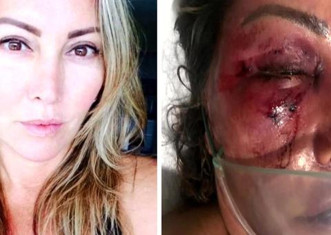 Suspeito de agredir mulher por 4h deu nome falso para entrar em prédio  