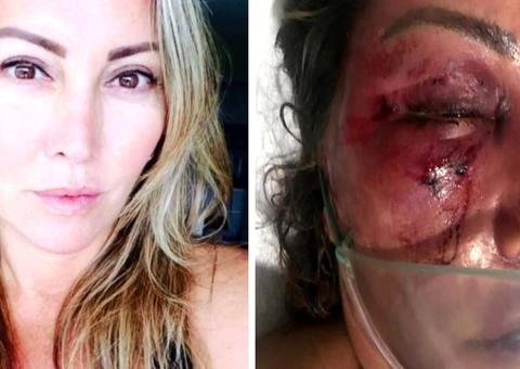 Justiça decreta prisão preventiva de homem suspeito de espancar empresária 