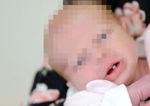 Mãe fica chocada ao notar que filha nasceu com um dente
