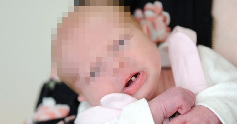 Mãe fica chocada ao notar que filha nasceu com um dente