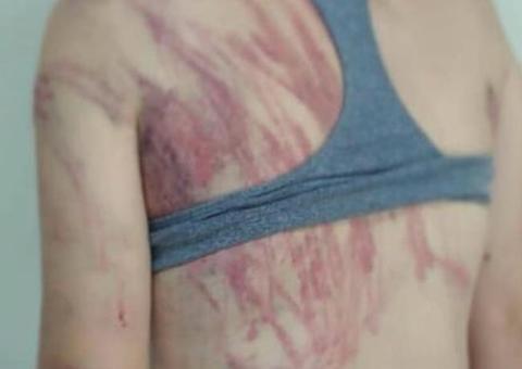 Polícia prende homem suspeito de chicotear mulher abraçada ao filho de 8 meses 