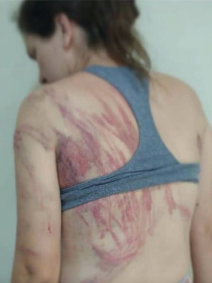 Polícia prende homem suspeito de chicotear mulher abraçada ao filho de 8 meses 