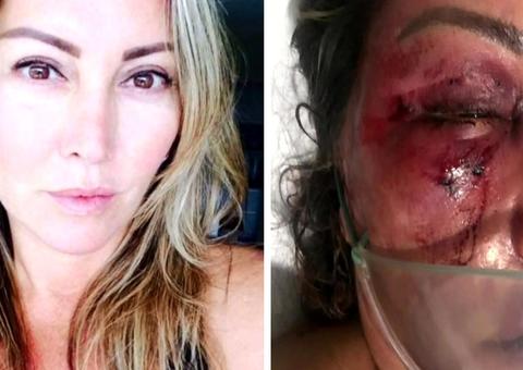 Mulher agredida em 1º encontro deve receber alta amanhã