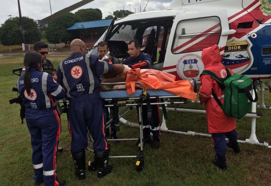 Menino de 13 anos escapa da morte após ser mordido por surucucu no Amazonas