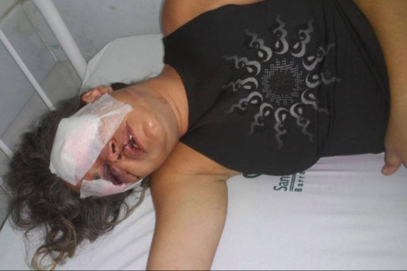 Mulher é espancada e tem rosto desfigurado por ex-marido ciumento 