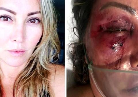 Agressão a mulher dentro de casa no Rio foi premeditada, diz polícia