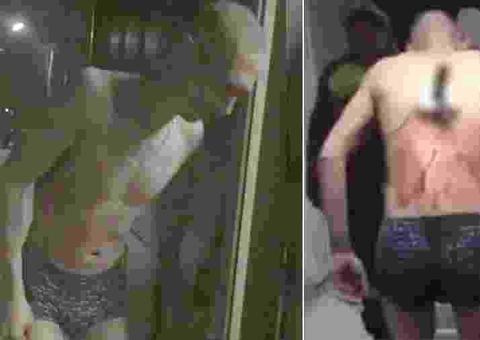 Homem sai de hospital com faca cravada nas costas para fumar um cigarro