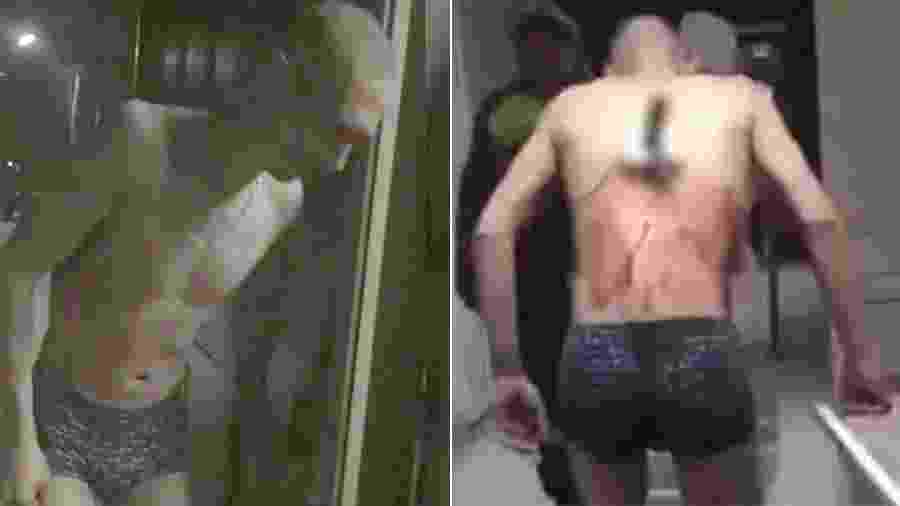 Homem sai de hospital com faca cravada nas costas para fumar um cigarro