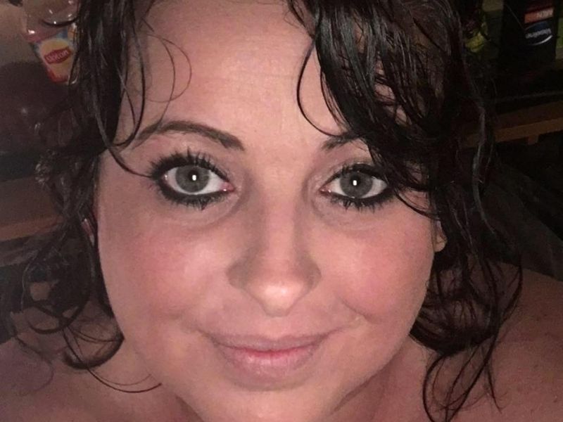 Mulher descobre que ficou 11 anos com DIU em seu abdômen