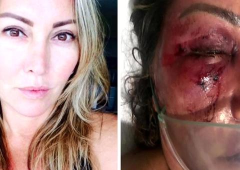 Homem que espancou empresária deixou local achando que ela estava morta, diz MP