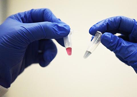 SUS terá nova modalidade de compra para medicamentos de doenças raras