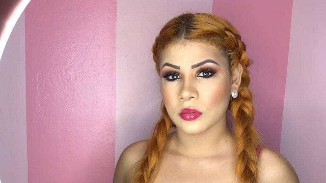 MP nega pedido de prisão a blogueira que arrancou parte de lábios de funcionária pública