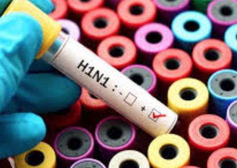 Enquanto vacina não chega, comitê define ações de combate ao H1N1 no Amazonas