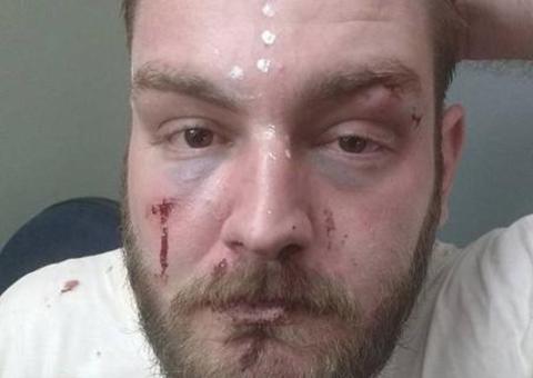 Vídeo mostra PM quebrando braço de dirigente do PT em delegacia 