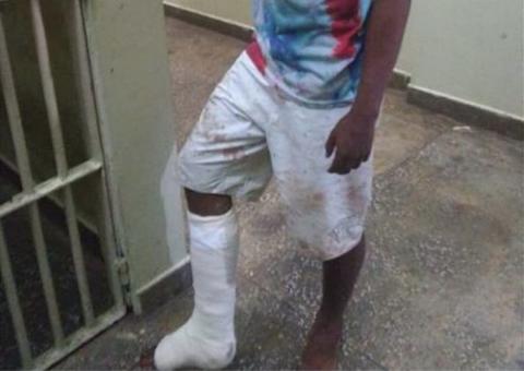 Suspeito de roubo tem perna quebrada ao ser agredido por populares no Amazonas