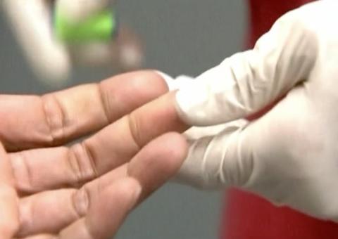 Homem é curado de HIV após passar por transplante com células tronco