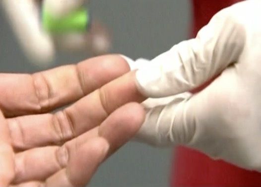 Homem é curado de HIV após passar por transplante com células tronco