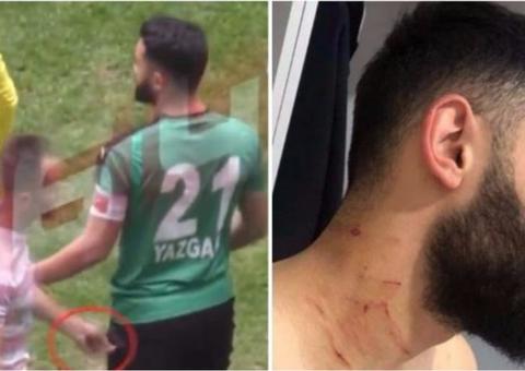 Jogador é investigado por atacar adversários com lâmina durante partida