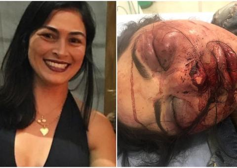 Justiça manda prender suspeito de agredir e abandonar namorada