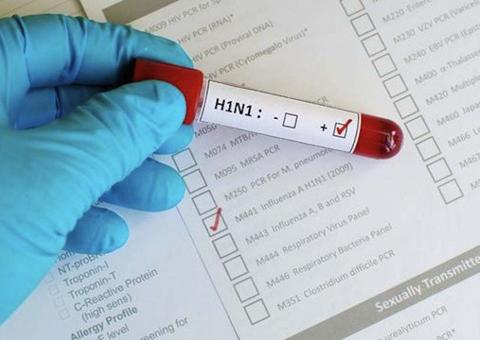 Amazonas tem quase 70 casos confirmados de H1N1 e número de óbitos sobe para 17