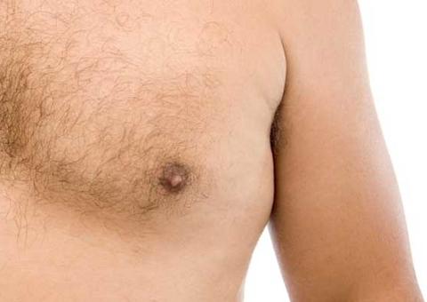 Artigo de residente da FCecon revela perfil de homens com câncer de mama no Amazonas