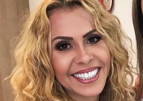 Joelma surge transformada e impressiona após procedimentos estéticos 