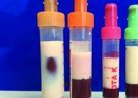 Sangue de homem fica branco de tanta gordura