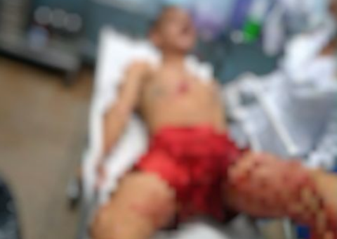 Homem é baleado durante troca de tiros com a polícia 