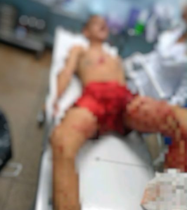 Homem é baleado durante troca de tiros com a polícia 