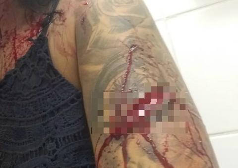 Modelo é agredida com garrafa após discussão por ciúmes