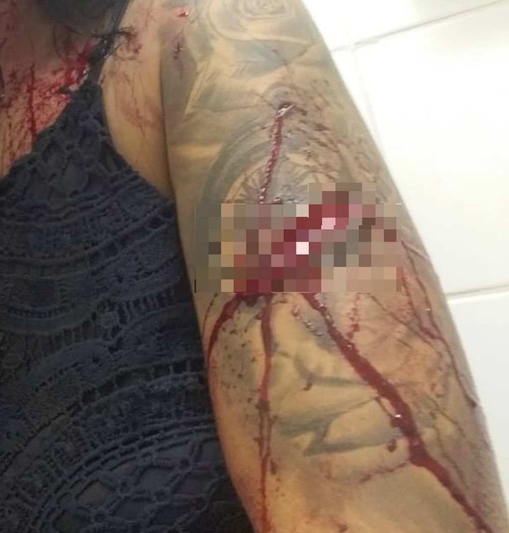 Modelo é agredida com garrafa após discussão por ciúmes